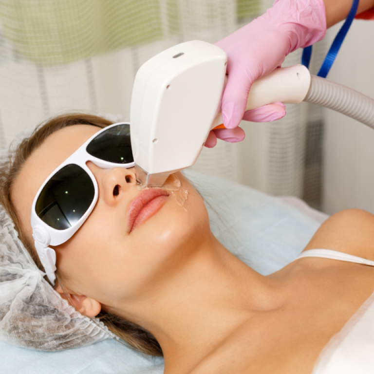 laser treatment